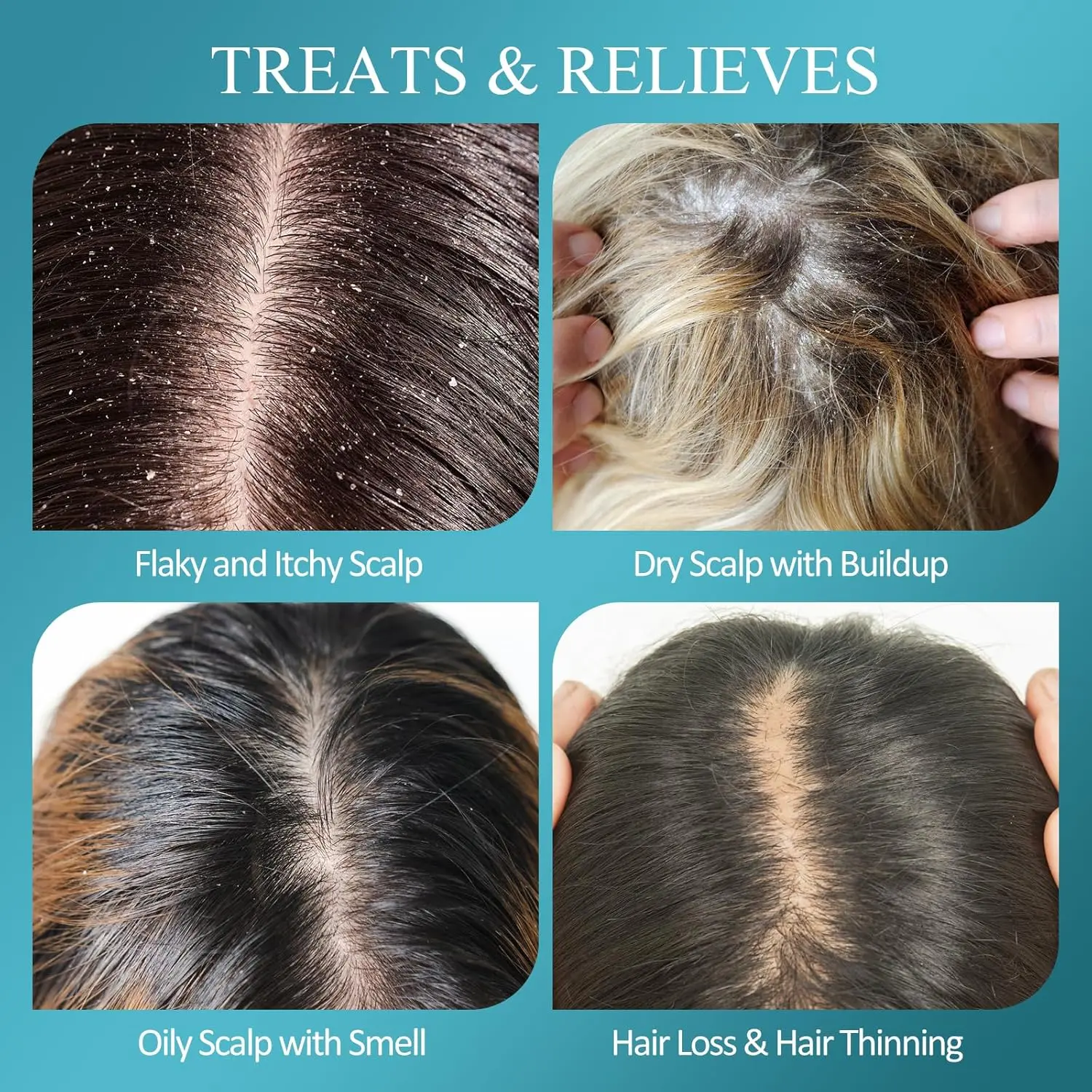 This scalp scrub with biotin and salicylic acid gently exfoliates and reduces dandruff, leaving your scalp clean, nourished, and promoting hair growth.