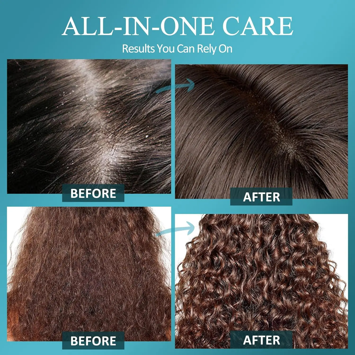 This scalp scrub with biotin and salicylic acid gently exfoliates and reduces dandruff, leaving your scalp clean, nourished, and promoting hair growth.