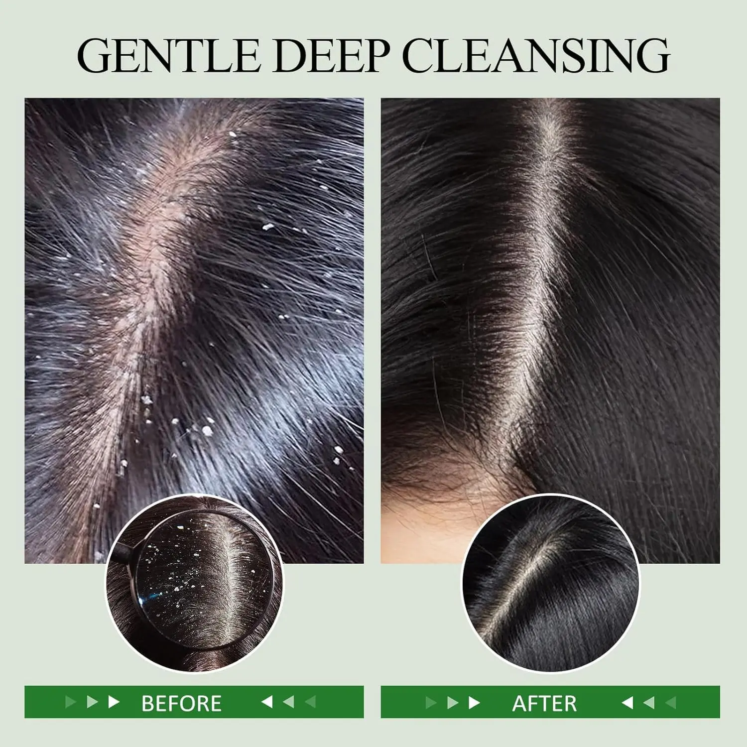 Shvyog rosemary scalp scrub exfoliates and nourishes the scalp while promoting hair growth, and includes a silicone massager for a complete hair treatment.