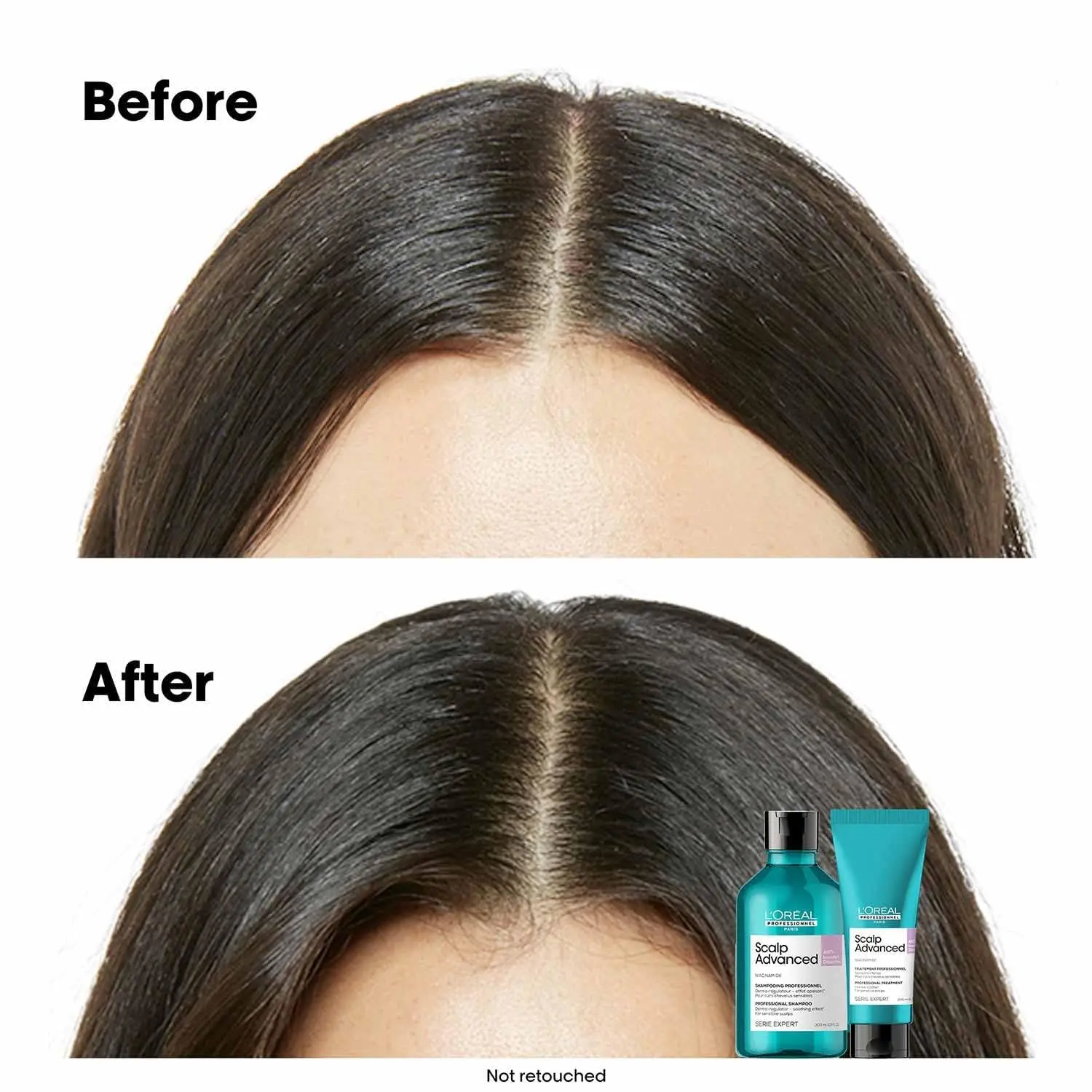 L'Oréal Professionnel Scalp Advanced soother treatment with Niacinamide calms scalp discomfort, hydrates hair, and soothes sensitivity.