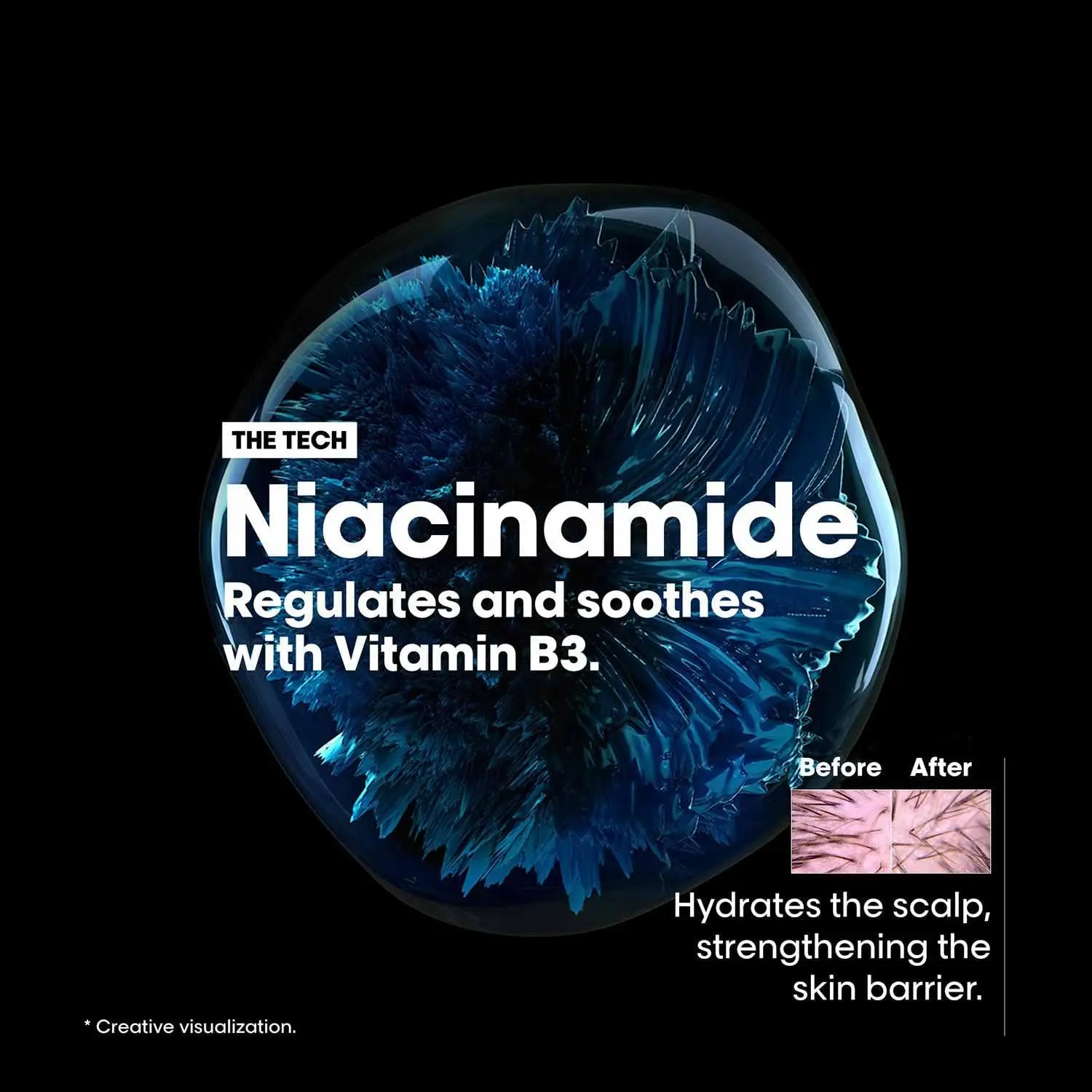 L'Oréal Professionnel Scalp Advanced soother treatment with Niacinamide calms scalp discomfort, hydrates hair, and soothes sensitivity.