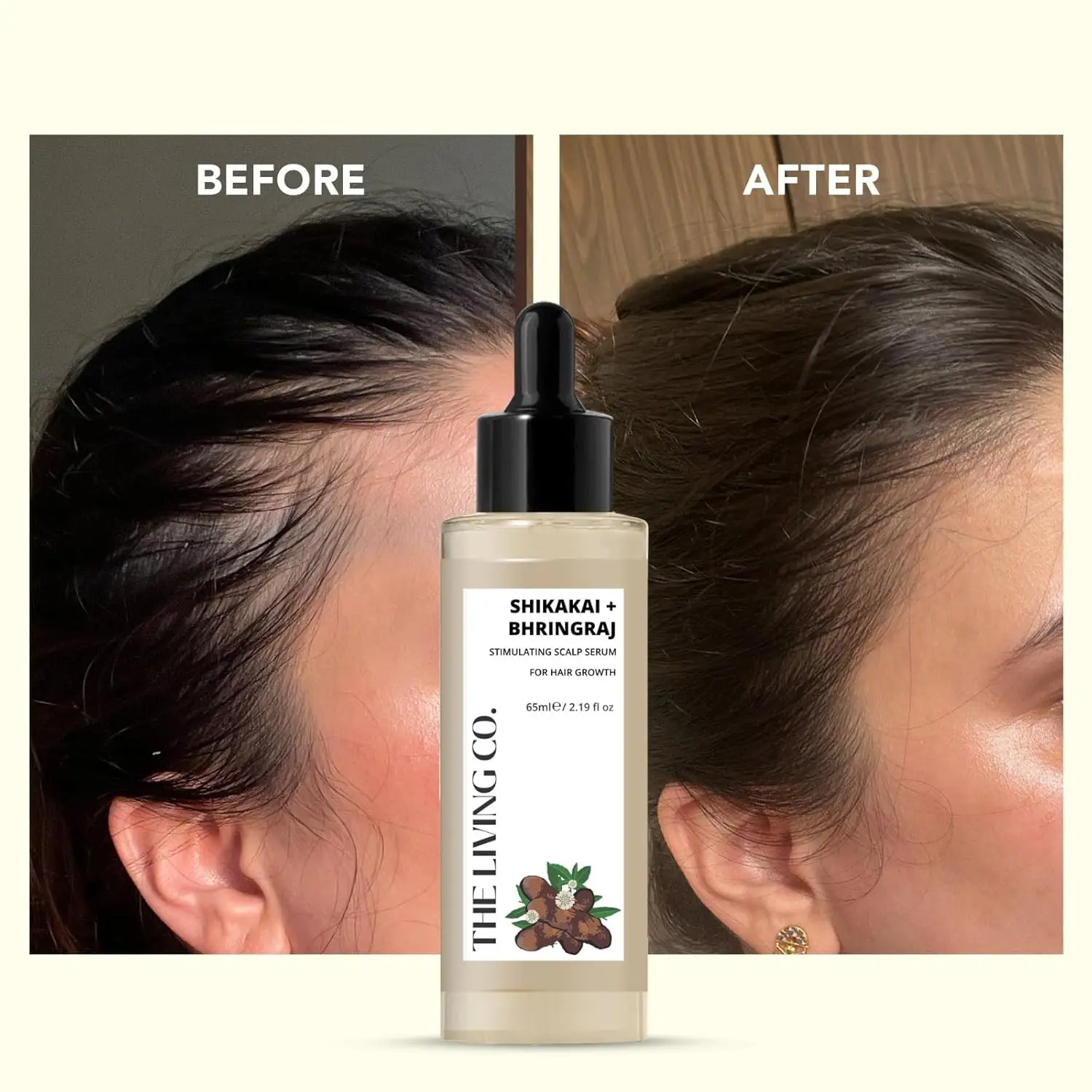 The Living Co. hair serum with shikakai and bhringraj extracts stimulates the scalp, strengthens hair, adds shine, promotes growth, controls dandruff, and prevents premature graying with pea protein, amla, and neem.