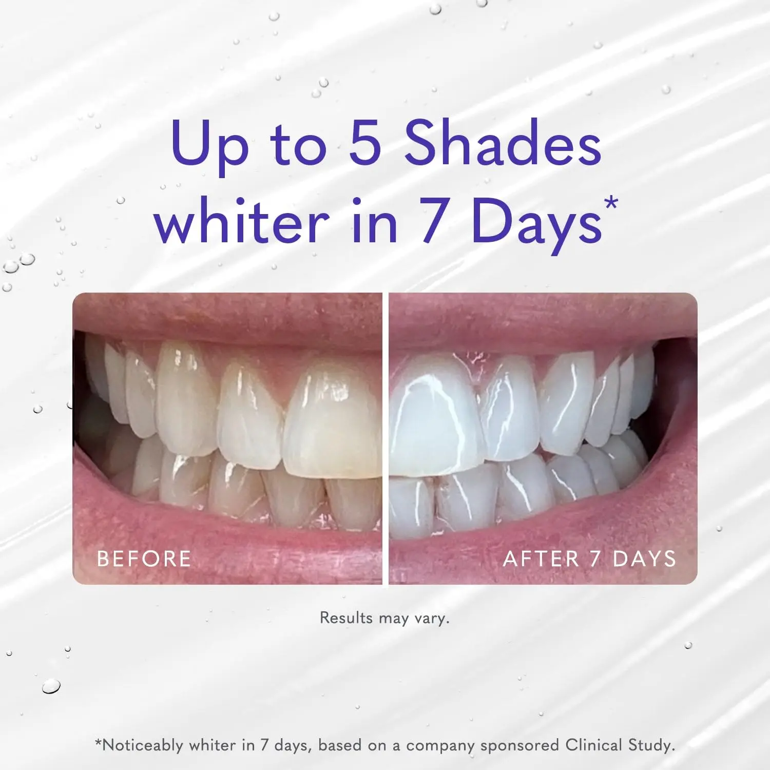 Smileactives whitening gel whitens teeth with Polyclean Technology, removing stains for a brighter, more confident smile in just 7 days.