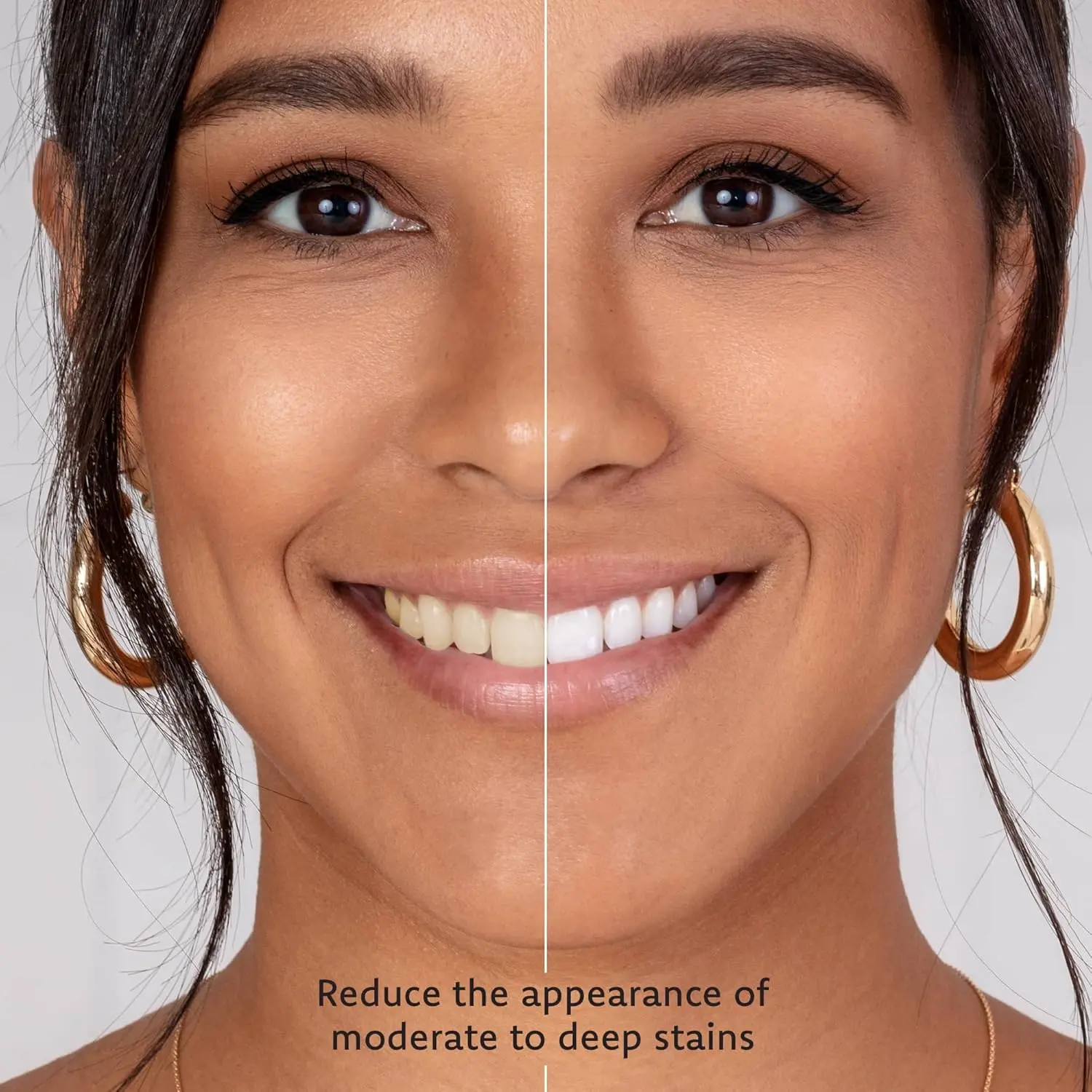 This image shows a set of four minty teeth whitening gel syringes with 35% carbamide peroxide, designed for use with teeth whitening trays to remove stains and brighten your smile.