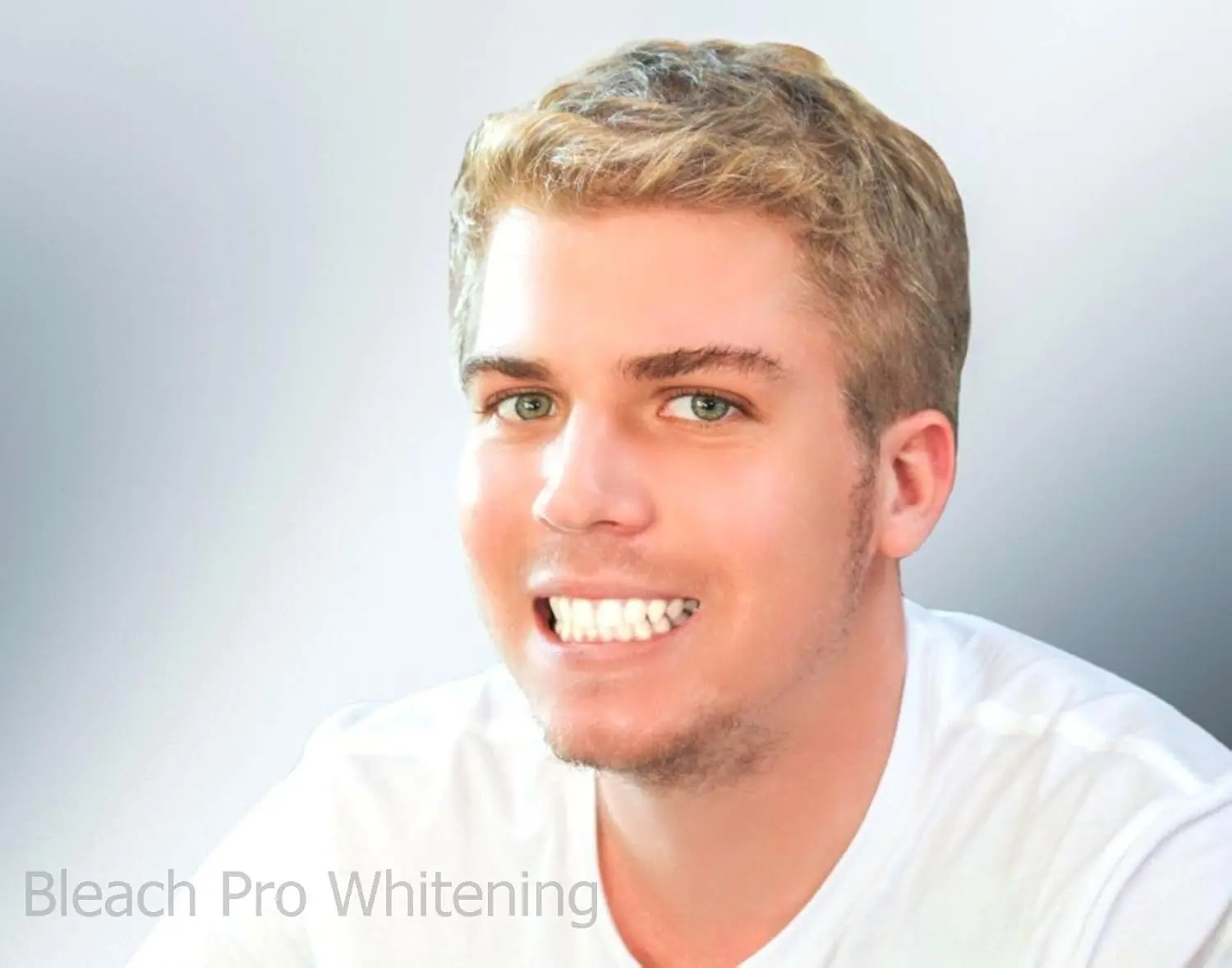 Ten 3ml syringes of 22% carbamide peroxide teeth whitening gel, a professional strength formula made in the USA for removing stubborn stains at home.