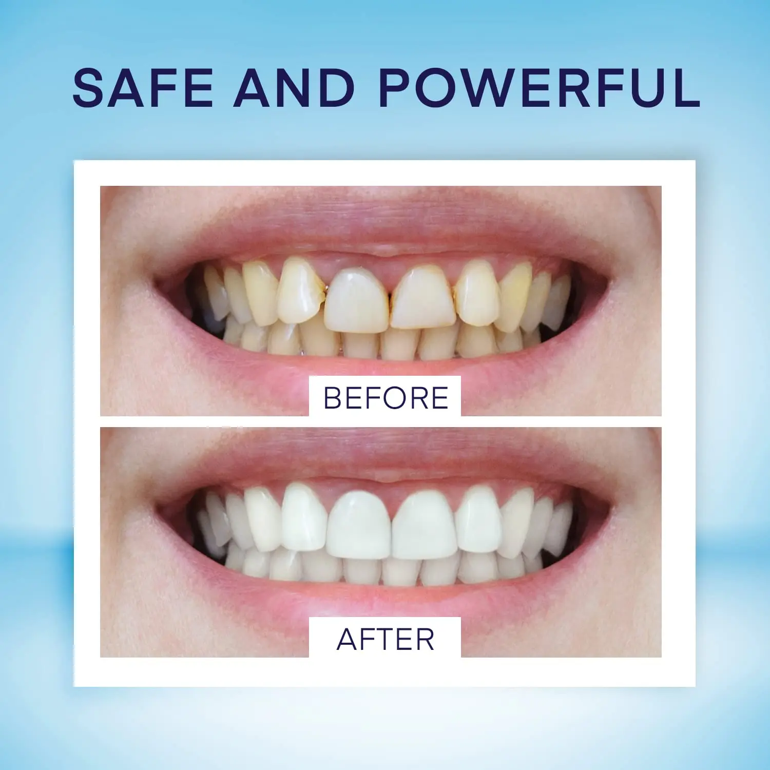 Four teeth whitening pens in packaging promise a beautiful white smile with minty freshness and no sensitivity, perfect for removing years of stains from coffee, tea, or smoking, and travel-friendly.