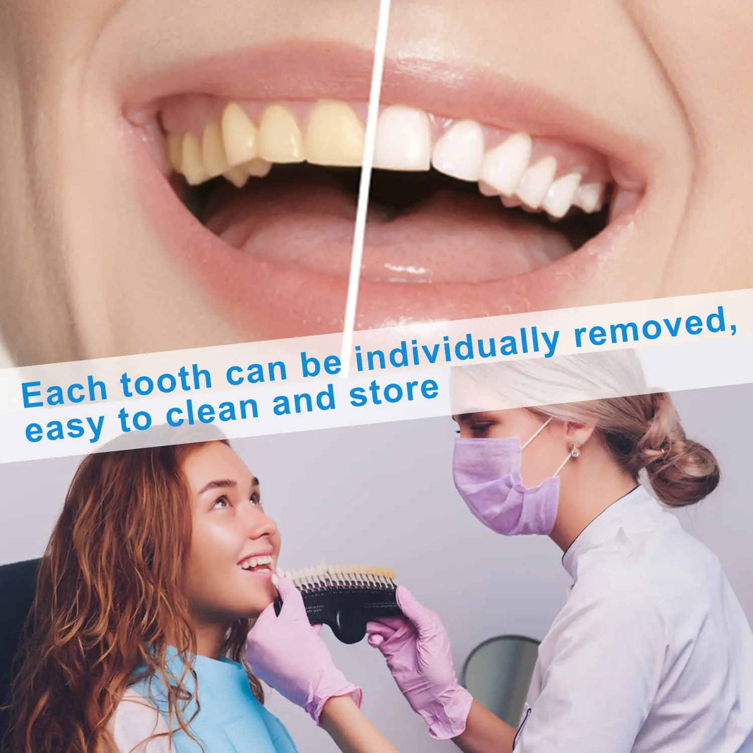 The EZGO professional dental teeth whitening shade guide with 20 colors helps dentists track and compare whitening effects before and after bleaching.