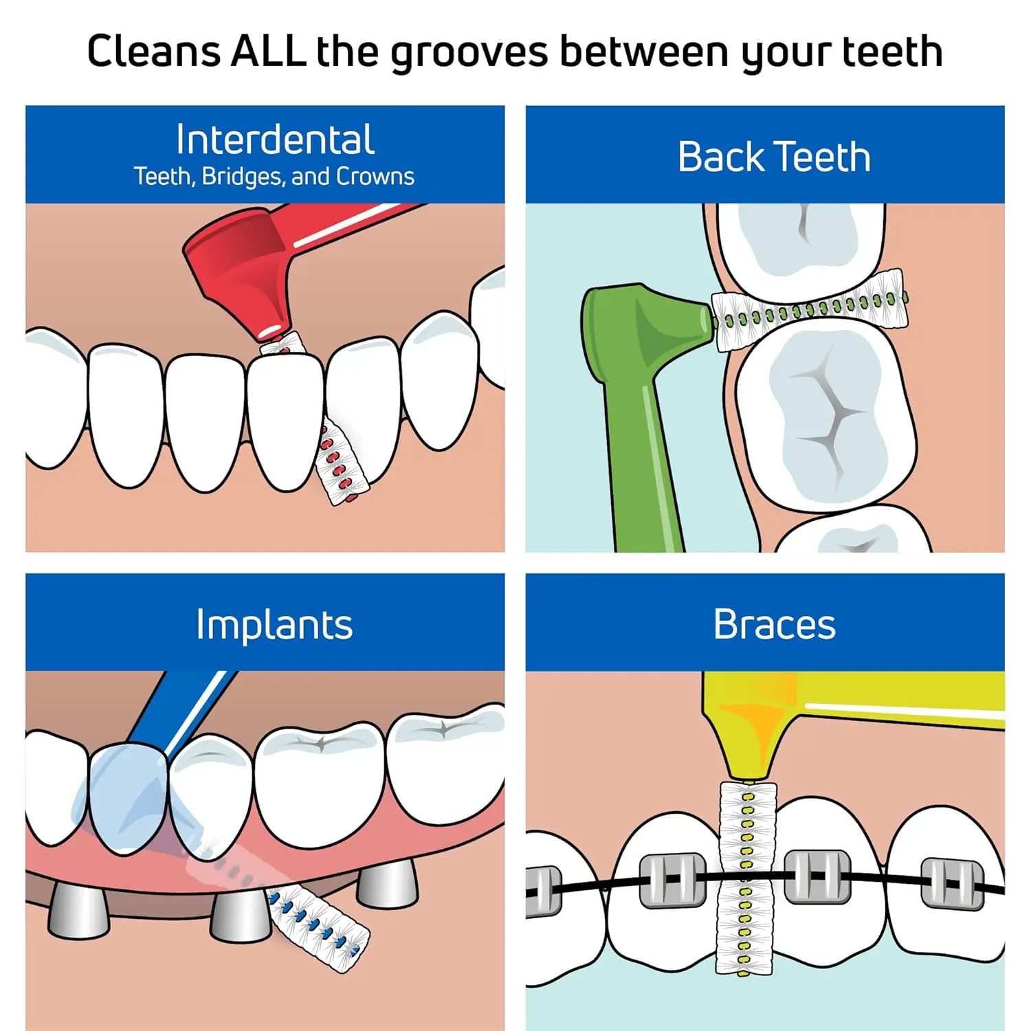 Tepe Angle interdental brushes with long handle and pre-angled head for better access and gentle cleaning to safeguard against gum inflammation and bad breath.