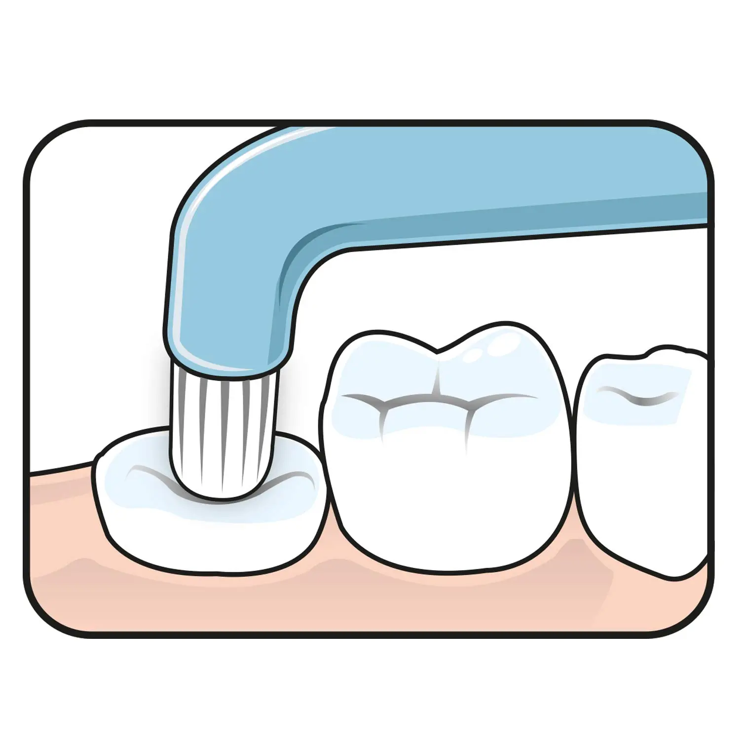 A close-up of the TePe Compact Tuft Brush, a small, angled toothbrush with soft, round bristles, designed for cleaning around implants, bridges, and braces.