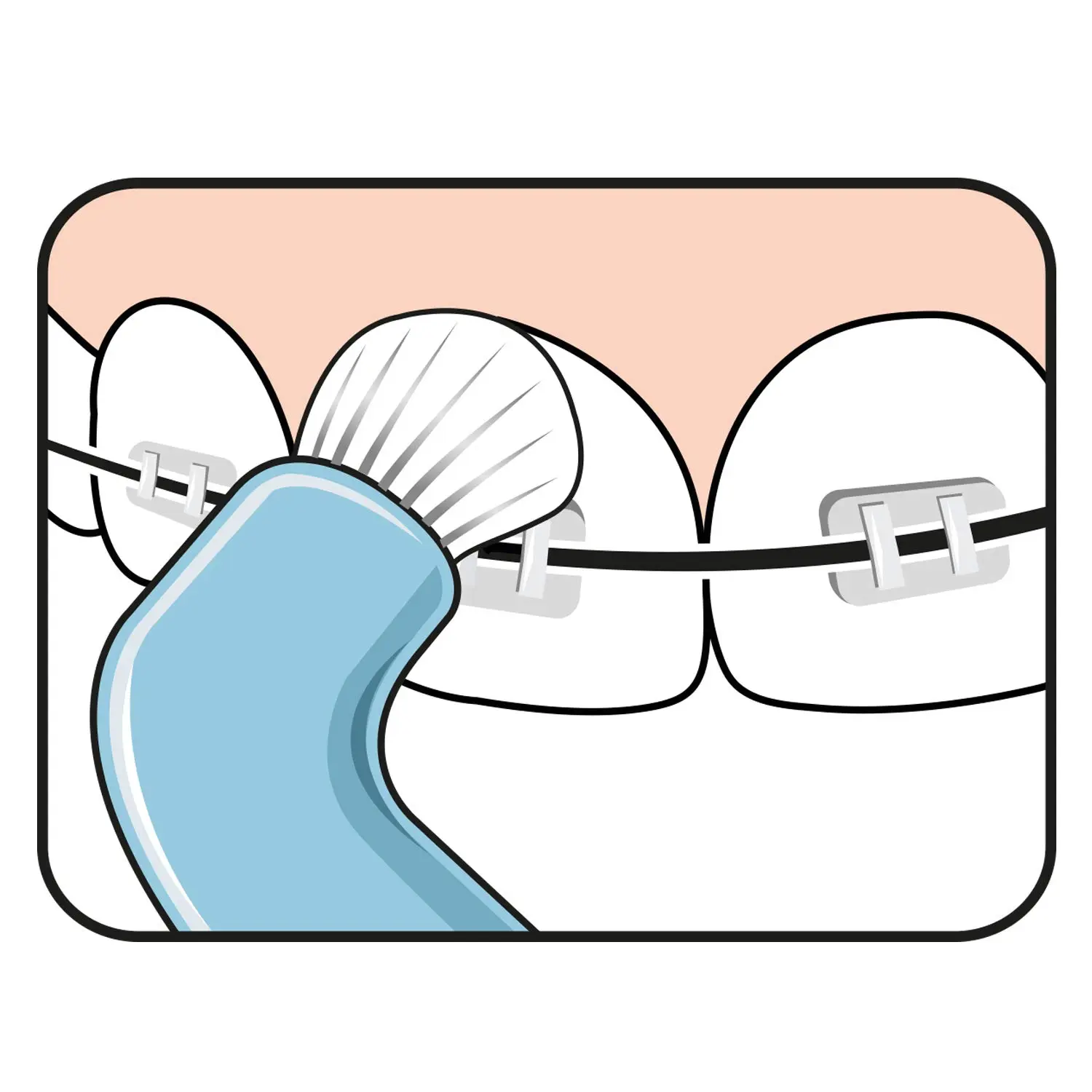 A close-up of the TePe Compact Tuft Brush, a small, angled toothbrush with soft, round bristles, designed for cleaning around implants, bridges, and braces.