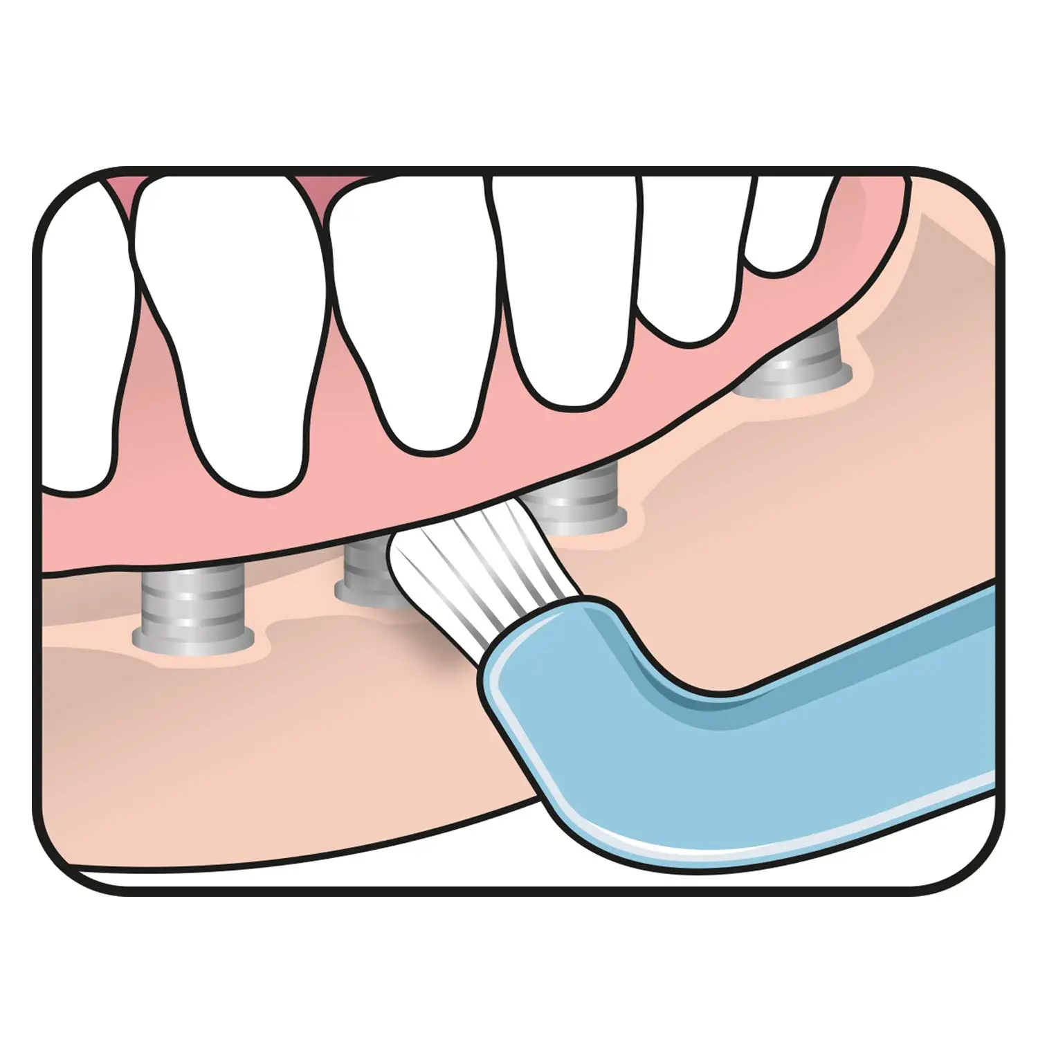 A close-up of the TePe Compact Tuft Brush, a small, angled toothbrush with soft, round bristles, designed for cleaning around implants, bridges, and braces.