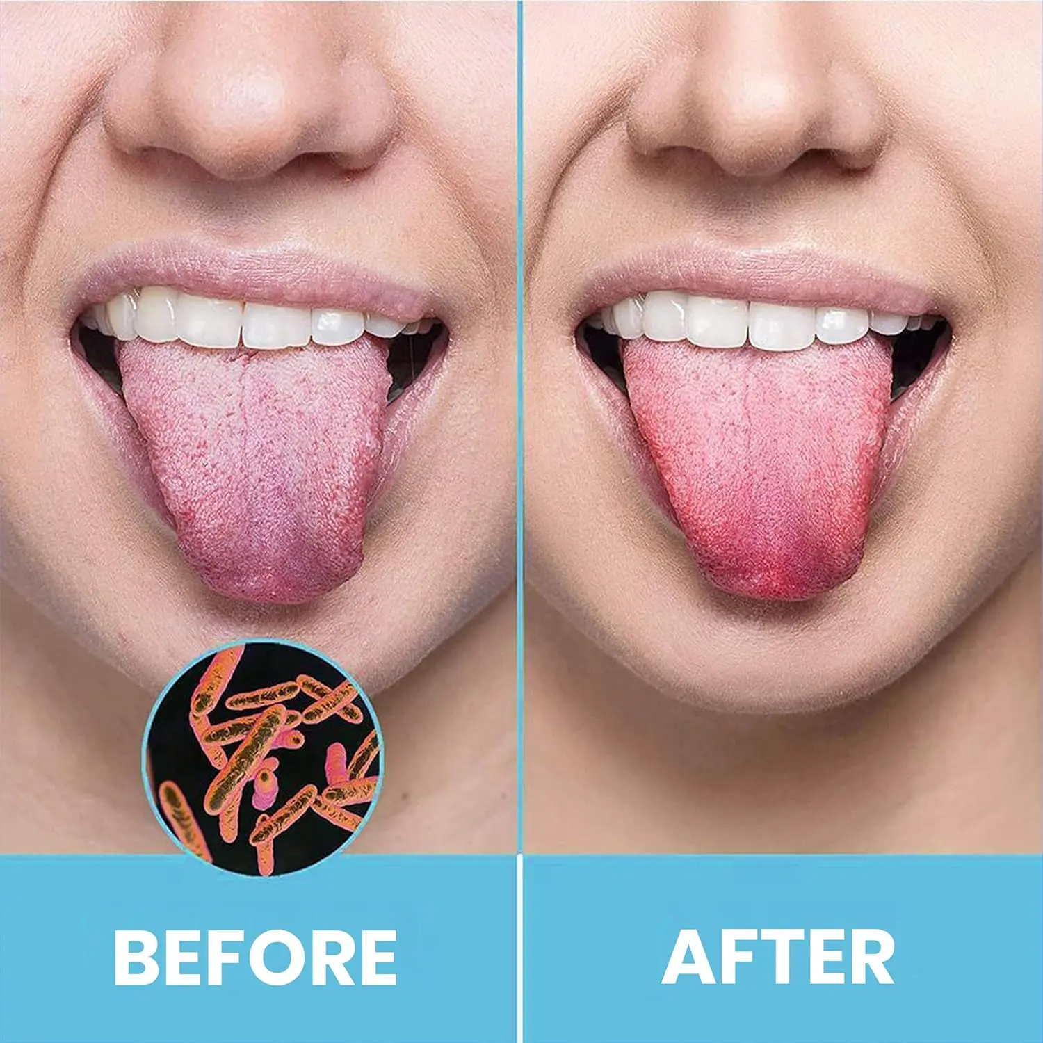 This stainless steel tongue scraper effectively reduces bad breath for adults, featuring a U-shaped design to gently clean the tongue and improve oral hygiene.