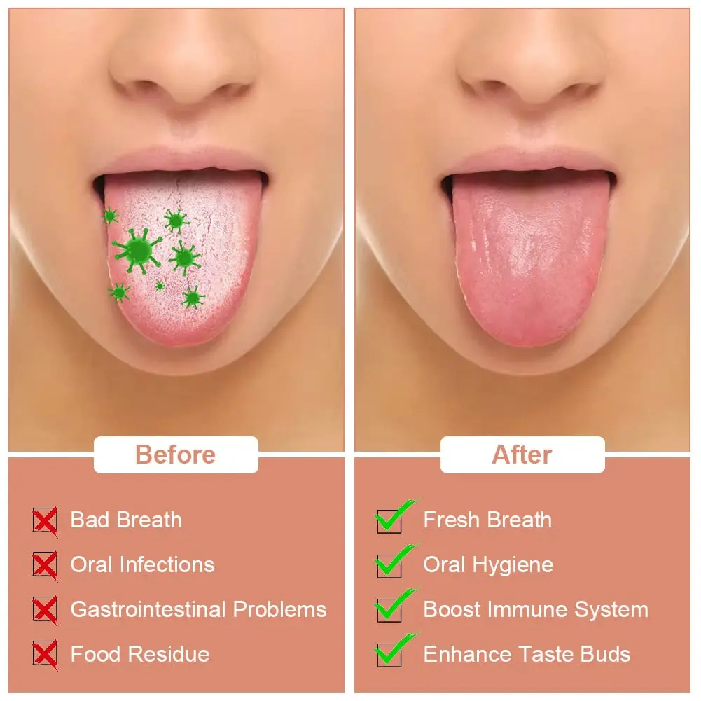 This three-piece stainless steel tongue scraper set includes U-shaped, double-sided, and spoon-shaped scrapers for effective tongue cleaning and fresh breath for adults.