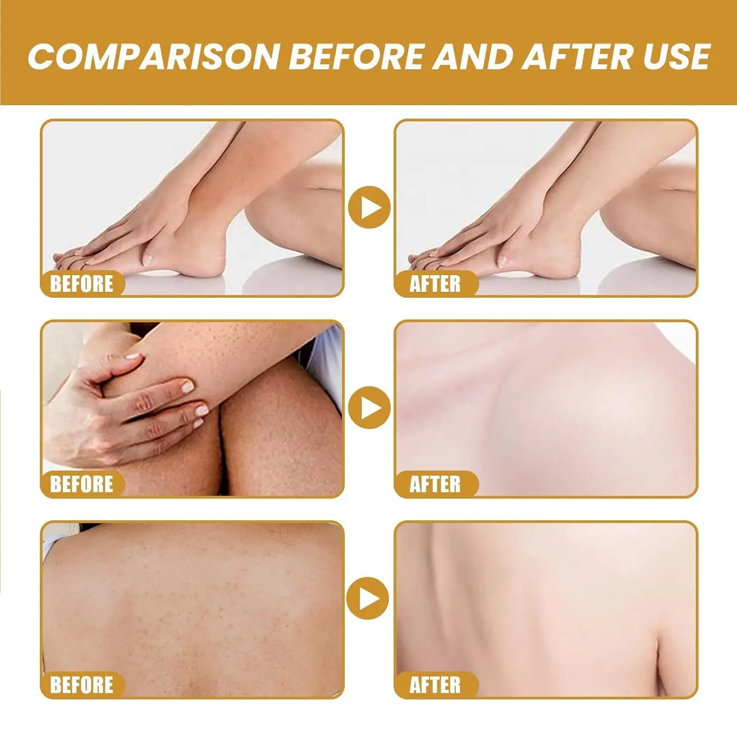 This turmeric body scrub exfoliates dead skin, brightens dark spots, and deeply moisturizes for soft, radiant skin.