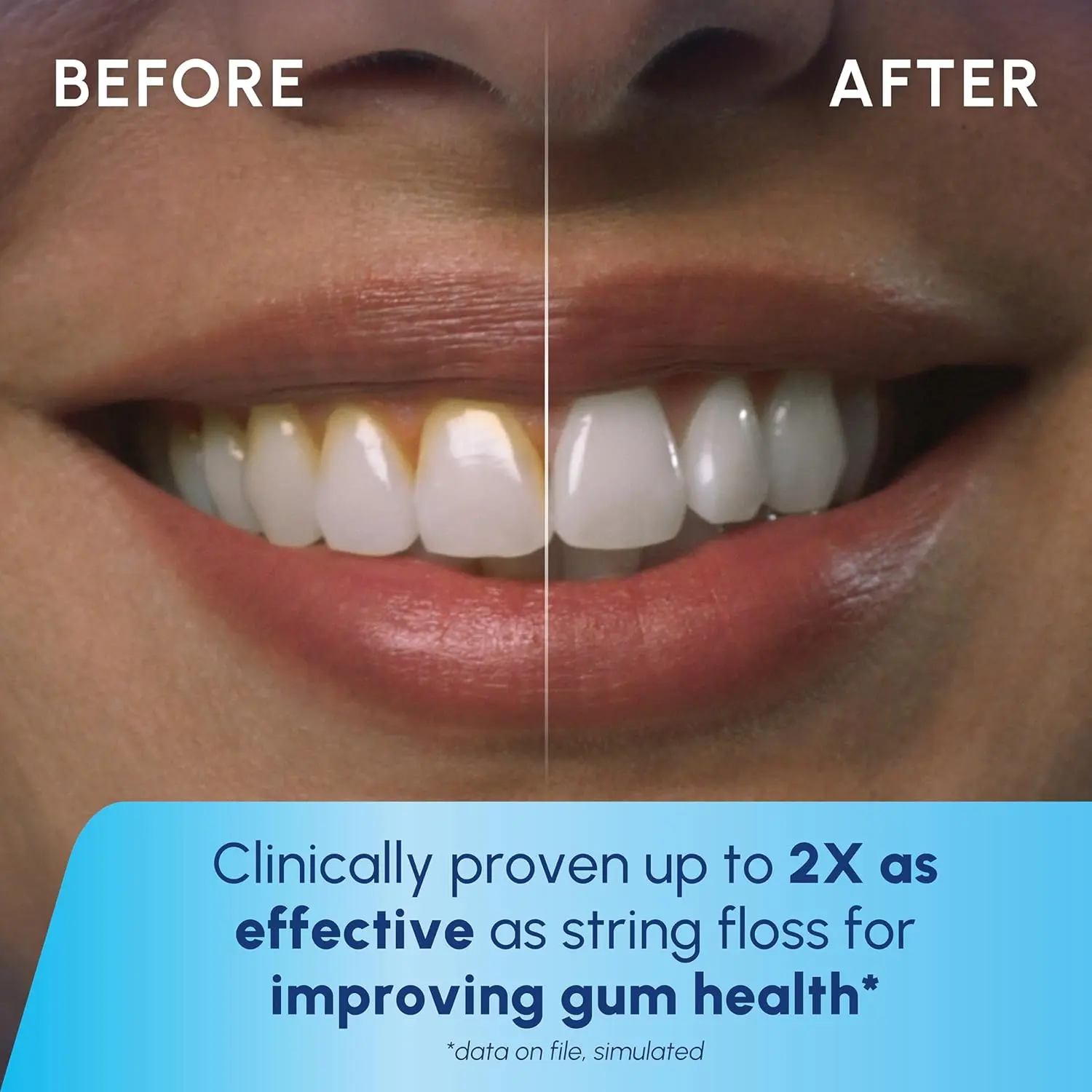 A white Waterpik Cordless Express water flosser is shown, a portable and battery-operated oral hygiene solution accepted by the ADA for effective plaque removal and gum health.