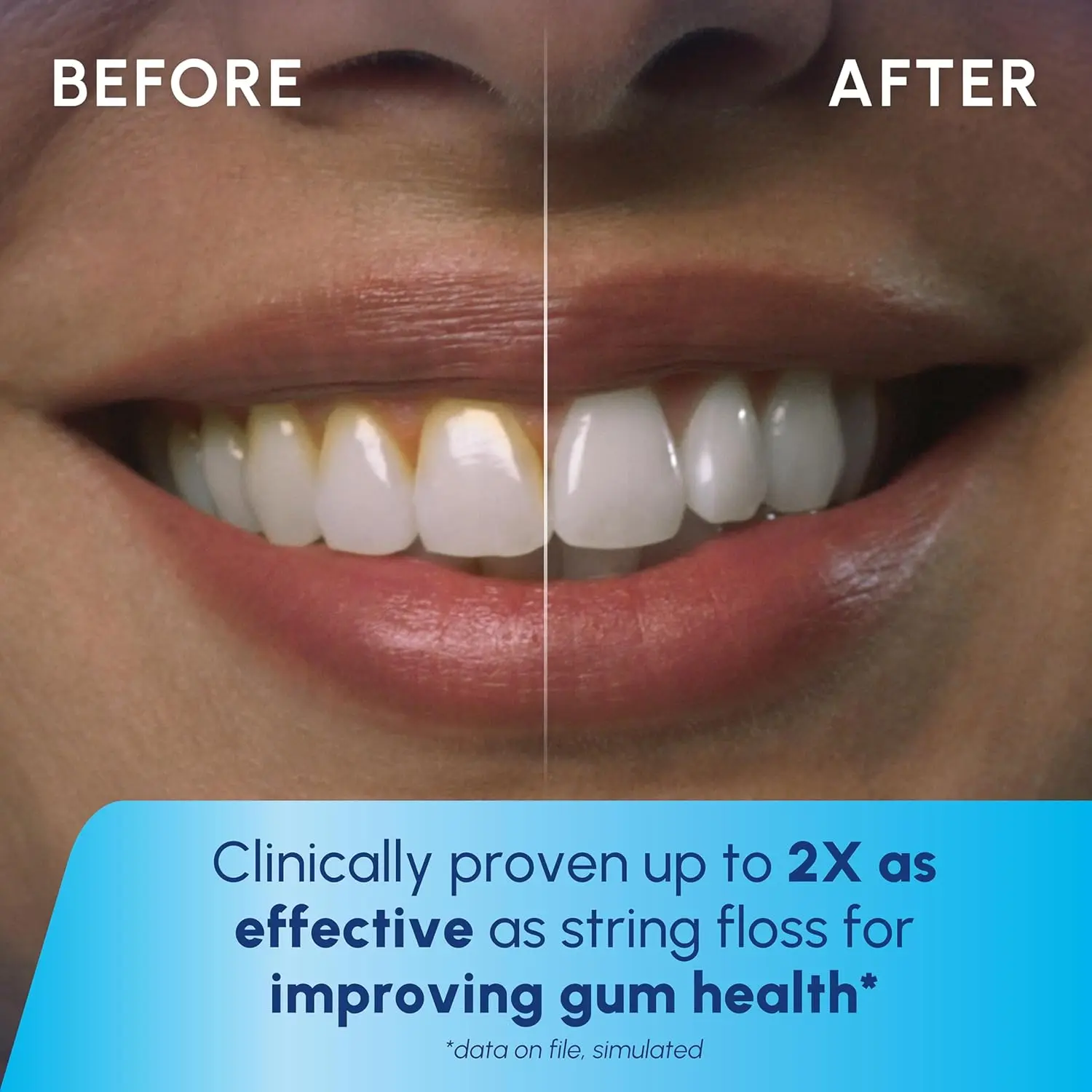 This is a Waterpik Cordless Pulse rechargeable water flosser for teeth and gum care, featuring two flossing tips and a waterproof design.