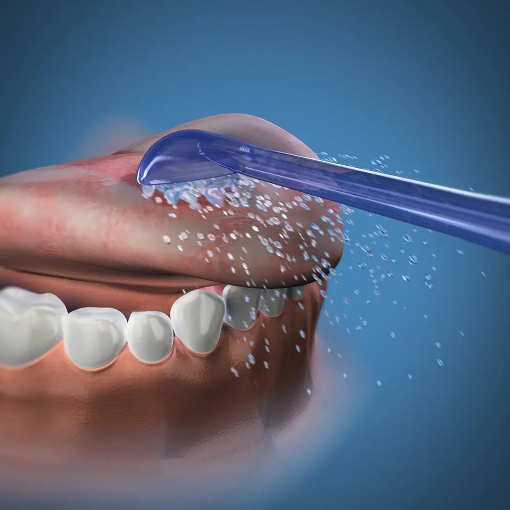 This pack of two Waterpik tongue scraper attachments helps remove bacteria and plaque for fresher breath and a cleaner mouth as part of your daily oral hygiene routine.